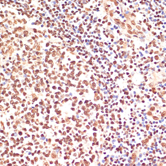 Anti-PARP1 Antibody (CAB0010)