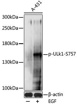 Anti-Phospho-ULk1-S757 Antibody (CABP0736)