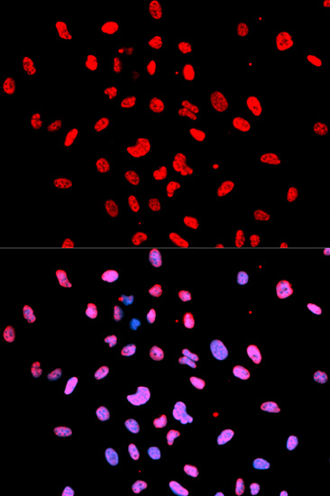 Anti-Phospho-Btk-Y223 Antibody (CABP0100)