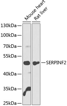 Anti-SERPINF2 Antibody (CAB14043)