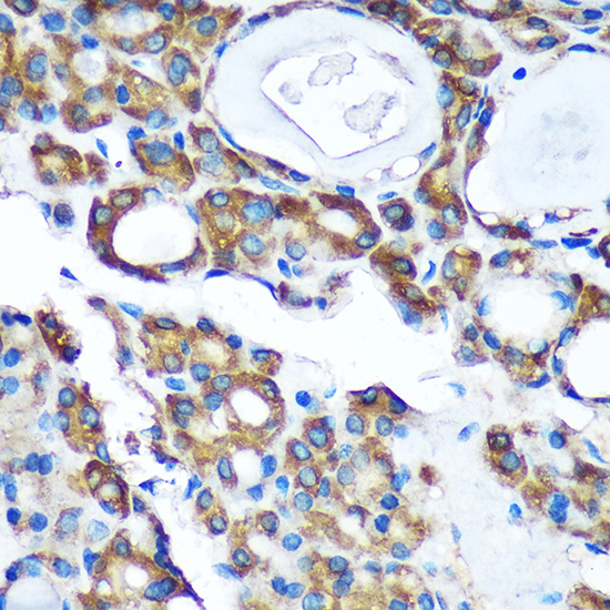 Anti-PDXDC1 Antibody (CAB14856)