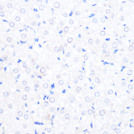 Anti-RANBP2 Antibody (CAB18596)