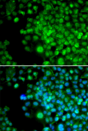 Anti-FHL1 Antibody (CAB5460)