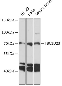 Anti-TBC1D23 Polyclonal Antibody (CAB9232)