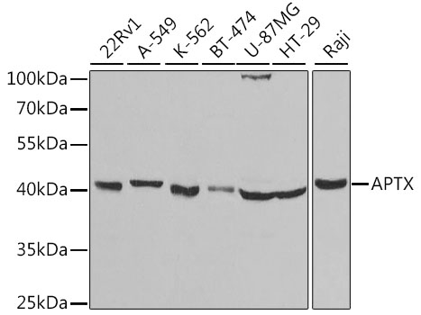 Anti-APTX Antibody (CAB5364)