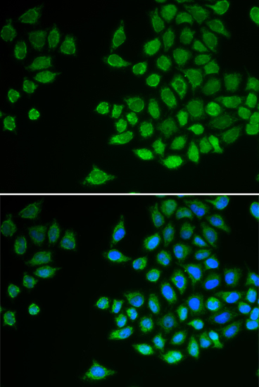 Anti-PTPN2 Antibody (CAB1808)