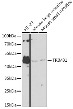 Anti-TRIM31 Antibody