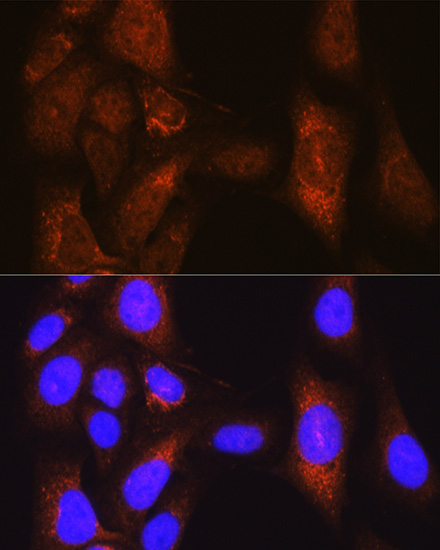 Anti-PLK1 Antibody (CAB2548)