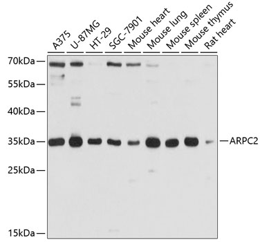 Anti-ARPC2 Antibody (CAB10791)