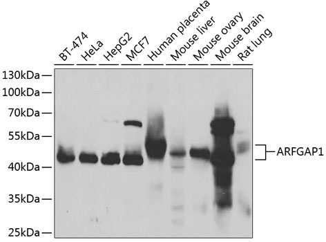 Anti-ARFGAP1 Antibody (CAB7118)