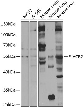 Anti-FLVCR2 Antibody (CAB7815)