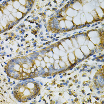 Anti-GSTM2 Antibody (CAB13496)