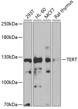 Anti-TERT Antibody (CAB2979)