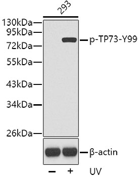 Anti-Phospho-Tumor protein p73-Y99 Antibody (CABP0465)