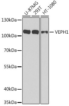 Anti-VEPH1 Polyclonal Antibody (CAB8510)