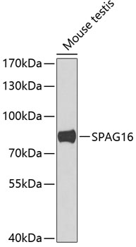 Anti-SPAG16 Antibody (CAB7482)