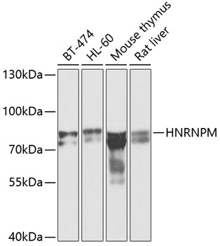 Anti-HNRNPM Antibody (CAB6937)