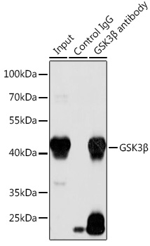 Anti-GSK3Beta Antibody (CAB16868)
