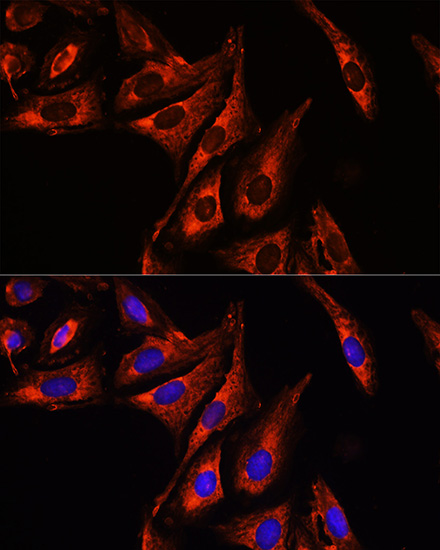 Anti-Cy3 Goat Anti-Mouse IgG (H+L) Antibody (CABS008)