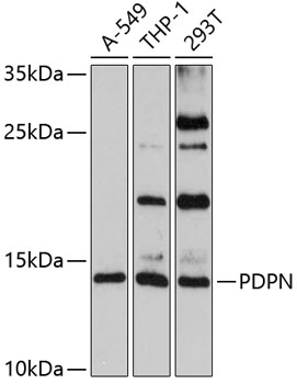 Anti-PDPN Antibody (CAB7166)