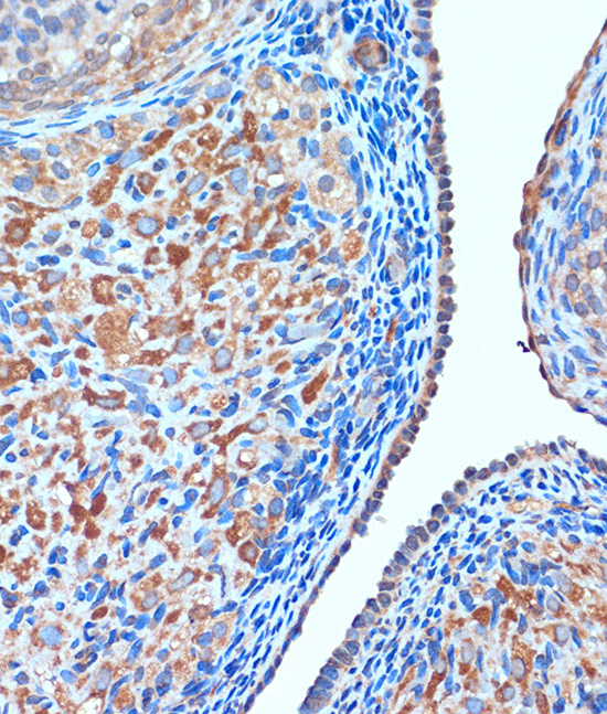 Anti-TCIRG1 Antibody (CAB15382)