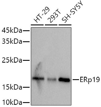 Western blot analysis of extracts of various cell lines, using at 1:1000 dilution. Secondary antibody: HRP Goat Anti-Rabbit IgG (H+L) at 1:10000 dilution. Lysates/proteins: 25ug per lane. Blocking buffer: 3% nonfat dry milk in TBST. Detection: ECL Basic Kit. Exposure time: 3s.