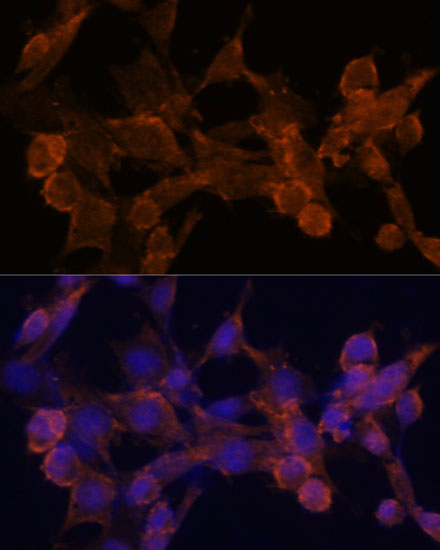 Anti-ARRB1 Antibody (CAB0190)