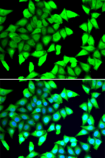 Anti-HDAC5 Antibody (CAB7189)