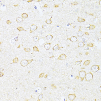 Anti-SQSTM1 / p62 Antibody (CAB7758)