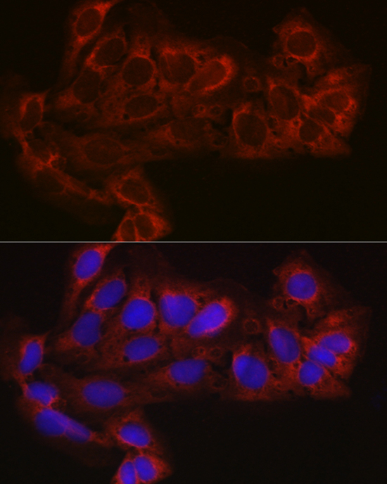 Anti-EIF4E2 Antibody (CAB4305)