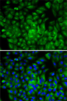 Anti-ATG16L1 Antibody (CAB1871)