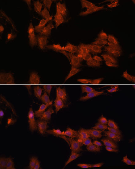 Anti-PDK4 Antibody (CAB13337)