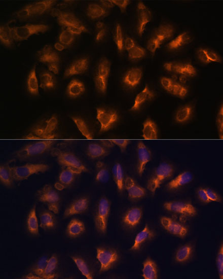 Anti-SSTR2 Antibody (CAB15101)