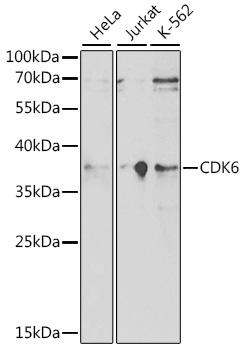 Anti-CDK6 Antibody (CAB16357)