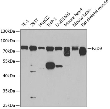 Anti-Frizzled-9 Polyclonal Antibody (CAB8311)