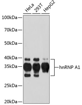 Anti-hnRNP A1 Antibody