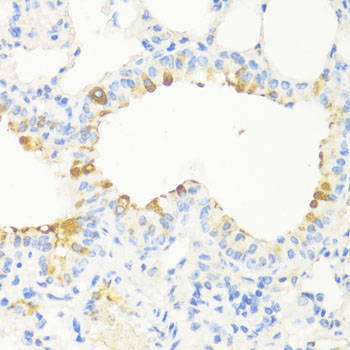 Anti-MAPRE3 Polyclonal Antibody (CAB9591)