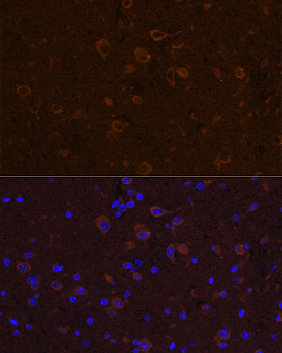 Anti-CNTF Antibody (CAB1915)