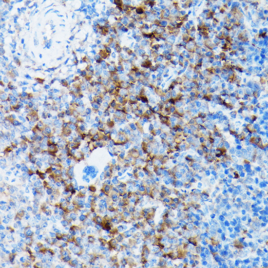 Anti-SLC8A1 Antibody (CAB5583)