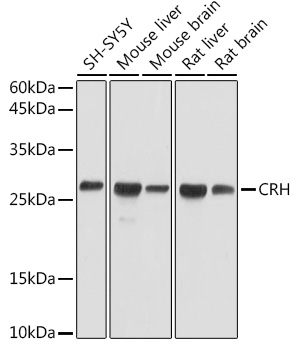 Anti-CRH Antibody (CAB1122)