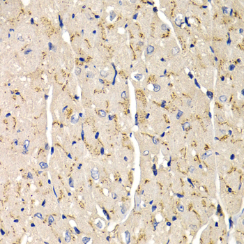 Anti-SFRP2 Antibody (CAB5383)