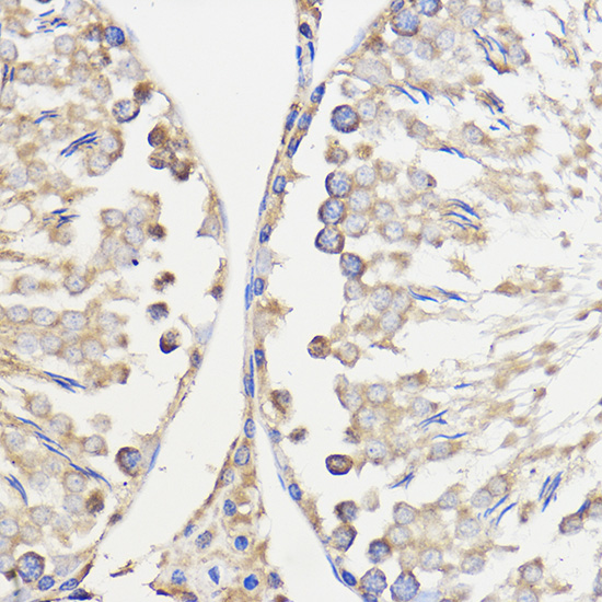 Anti-WBSCR27 Antibody (CAB16176)