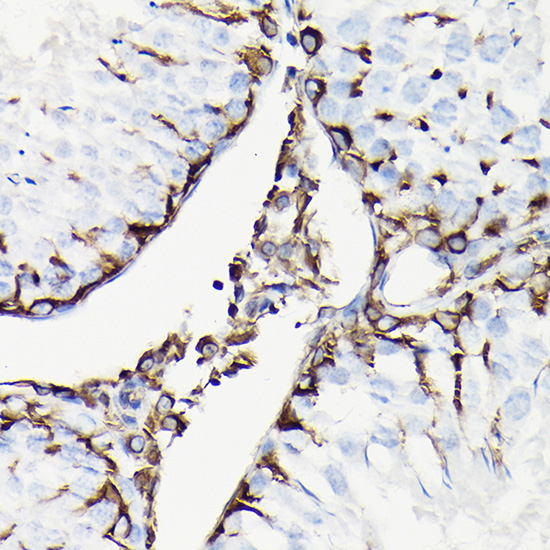 Anti-Vimentin Antibody (CAB11423)