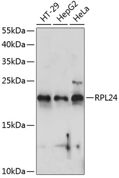 Anti-RPL24 Antibody (CAB14255)