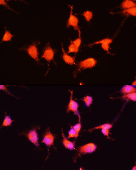 Anti-NGF Antibody (CAB14216)