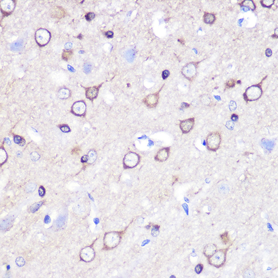 Anti-STMN1 Antibody (CAB2176)