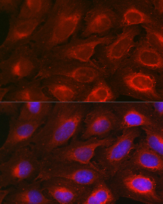 Anti-Bcl-2 Antibody (CAB0208)