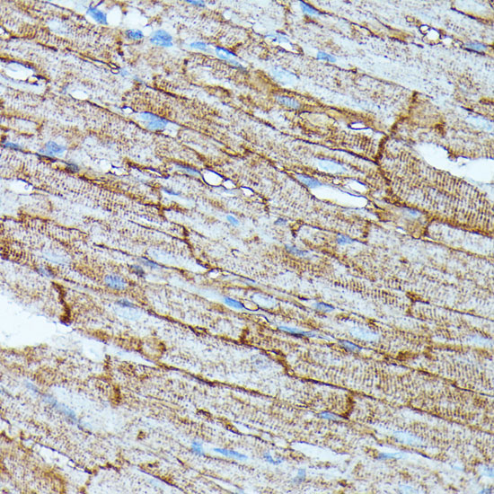 Anti-SLC14A1 Antibody (CAB15991)