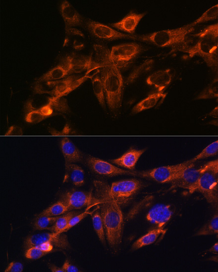 Anti-Src Antibody [KO Validated] (CAB19119)