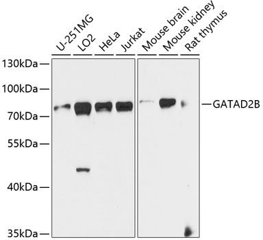 Anti-GATAD2B Polyclonal Antibody (CAB9716)